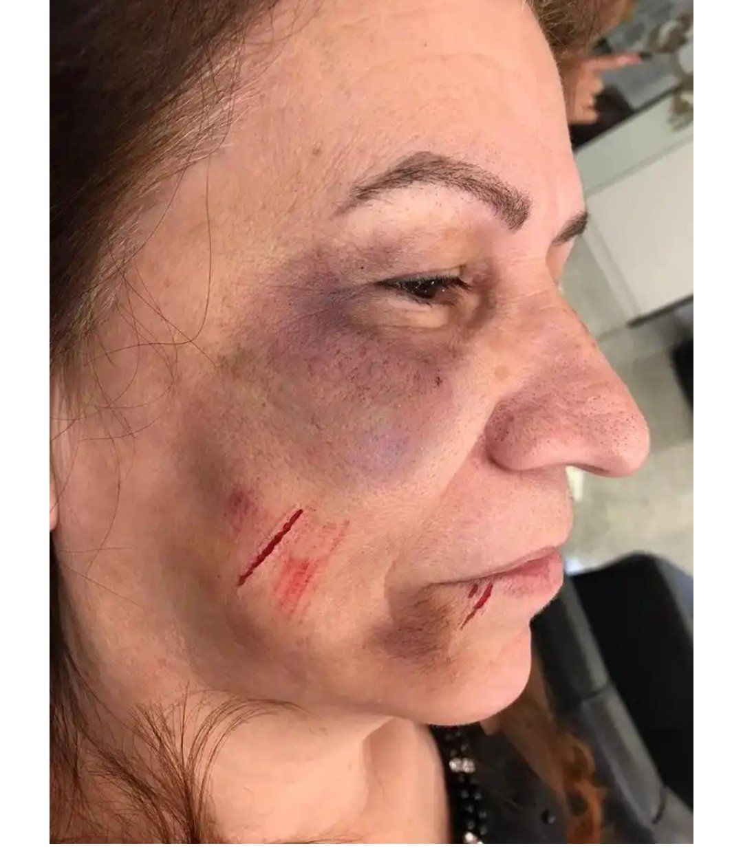 Servidoras de prefeitura de SC trabalham com maquiagem para simbolizar violência doméstica